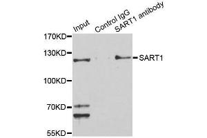Immunoprecipitation analysis of 150 μg extracts of Jurkat cells using 3 μg SART1 antibody (ABIN5996293). (SART1 anticorps)