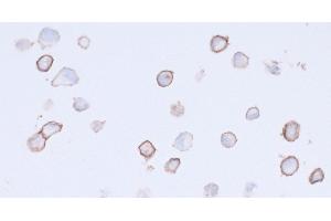Immunocytochemistry (ICC) image for anti-Platelet Derived Growth Factor Receptor alpha (PDGFRA) (AA 24-525) antibody (ABIN7453341)