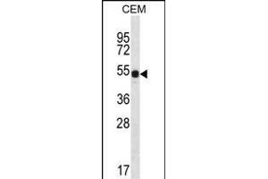 DAZ3 Antibody (C-term) (ABIN656239 and ABIN2845555) western blot analysis in CEM cell line lysates (35 μg/lane). (DAZ3 anticorps  (C-Term))