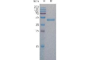 Human Protein, His Tag on SDS-PAGE under reducing condition.