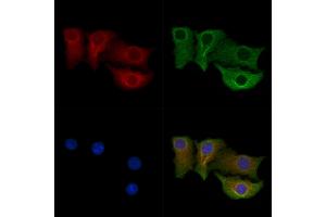 ABIN7094674 and ABIN7098725 staining Hela cells by IF/ICC. (CPEB4 anticorps  (Internal Region))