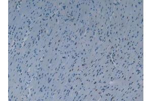 IHC-P analysis of Mouse Heart Tissue, with DAB staining. (KHDRBS1 anticorps  (AA 156-381))