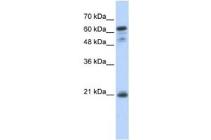 Western Blotting (WB) image for anti-Germinal Center Expressed Transcript 2 (GCET2) antibody (ABIN2459927) (GCET2 anticorps)