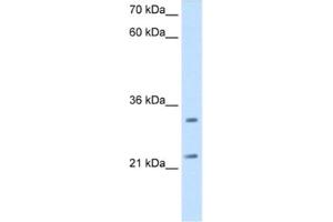 Western Blotting (WB) image for anti-Chromosome 21 Open Reading Frame 33 (C21orf33) antibody (ABIN2462904) (C21orf33 anticorps)