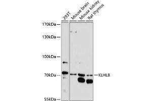 Western blot analysis of extracts of various cell lines, using KLHL8 antibody (ABIN7268081) at 1:1000 dilution. (KLHL8 anticorps  (AA 271-620))