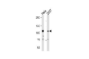 Western blot analysis of lysates from Hela, 293T cell line (from left to right), using EPHA10 Antibody (N-term) (ABIN391903 and ABIN2841719).