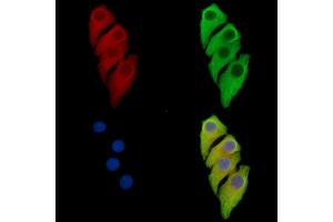 ABIN7097157 and ABIN7101225 staining Hela cells by IF/ICC. (MANBA anticorps)