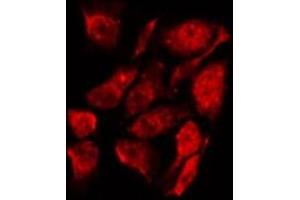 ABIN6267240 staining K562 by IF/ICC.