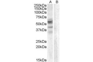 Image no. 1 for anti-Arylsulfatase D (ARSD) (Internal Region) antibody (ABIN374947) (Arylsulfatase D anticorps  (Internal Region))