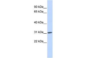WB Suggested Anti-ARD1A Antibody Titration:  0. (NAA10 anticorps  (Middle Region))