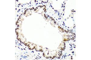 Immunohistochemistry of paraffin-embedded rat lung using TET2 antibody. (TET2 anticorps)