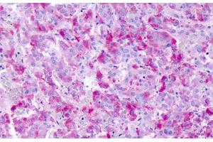 Anti-GPR139 antibody IHC staining of human adrenal medulla. (GPR139 anticorps  (Cytoplasmic Domain))