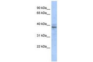 Image no. 1 for anti-Zinc Finger Protein 625 (ZNF625) (AA 67-116) antibody (ABIN6740632) (ZNF625 anticorps  (AA 67-116))