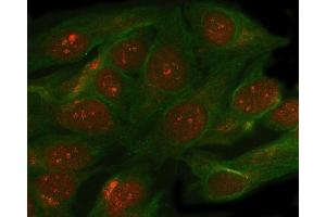 IF analysis of SMC5 using anti-SMC5 antibody (ABIN7600007) and anti-Beta Tubulin antibody (ABIN7602743). (SMC5 anticorps  (AA 14-1089))
