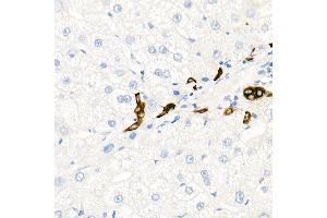 Immunohistochemistry of paraffin-embedded Human liver (negative control sample) using Cytokeratin 19 (KRT19) antibody (ABIN7268099) at dilution of 1:100 (40x lens). (Cytokeratin 19 anticorps)