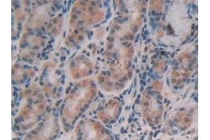 Detection of AFP in Human Stomach Tissue using Polyclonal Antibody to Alpha-Fetoprotein (AFP)