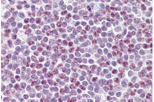 Anti-APOBEC3A antibody IHC staining of human tonsil. (APOBEC3A anticorps  (AA 7-20))