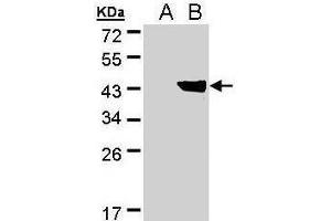 WB Image Western Blot analysis of DHDH expression in transfected 293T cell line by DHDH polyclonal antibody. (AKR1C1 anticorps)