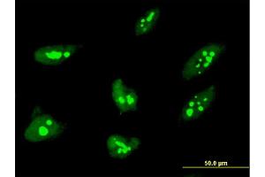 Immunofluorescence of monoclonal antibody to THAP1 on HeLa cell.