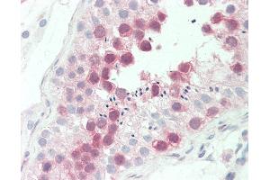 Anti-MPS1 / TTK antibody IHC staining of human testis. (Mps1 anticorps  (AA 1-176))