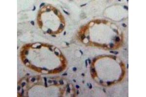 Used in DAB staining on fromalin fixed paraffin-embedded Kidney tissue (CD59 anticorps  (AA 23-105))