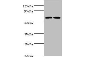 Western blot All lanes: CREB3L2 antibody at 6 μg/mL Lane 1: Mouse liver tissue Lane 2: Mouse lung tissue Secondary Goat polyclonal to rabbit IgG at 1/10000 dilution Predicted band size: 58, 51, 28 kDa Observed band size: 58 kDa (CREB3L2 anticorps  (AA 1-247))