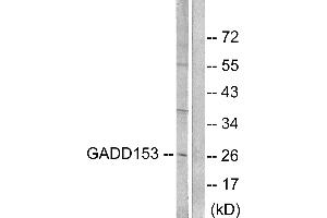 Western blot analysis of extracts from LOVO cells, treated with serum (10%, 15mins), using GADD153 antibody (#C0202). (DDIT3 anticorps)