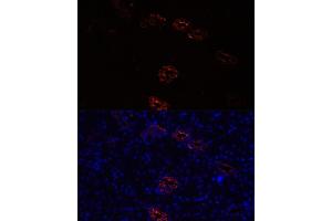 anti-Aquaporin 2 (Collecting Duct) (AQP2) (AA 147-271) antibody