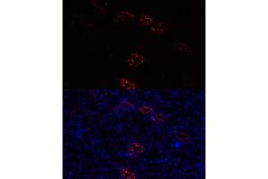 Immunofluorescence analysis of rat kidney cells using  antibody (ABIN7265652) at dilution of 1:100. (AQP2 anticorps  (AA 147-271))