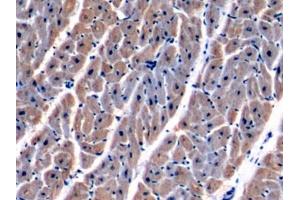 Detection of MDH2 in Human Cardiac Muscle Tissue using Polyclonal Antibody to Malate Dehydrogenase 2 (MDH2)