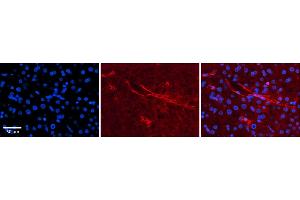Rabbit Anti-SLC5A5 Antibody  Catalog Number: ARP43751_P050 Formalin Fixed Paraffin Embedded Tissue: Human Adult liver  Observed Staining: Membrane Primary Antibody Concentration: 1:600 Secondary Antibody: Donkey anti-Rabbit-Cy2/3 Secondary Antibody Concentration: 1:200 Magnification: 20X Exposure Time: 0. (SLC5A5 anticorps  (N-Term))