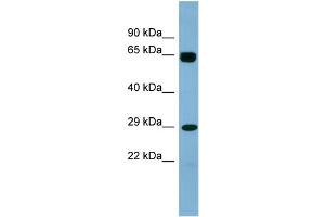WB Suggested Anti-LRRN4CL Antibody Titration: 0. (LRRN4CL anticorps  (Middle Region))