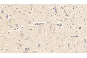 Detection of AHSG in Bovine Cerebellum Tissue using Polyclonal Antibody to Alpha-2-Heremans Schmid Glycoprotein (AHSG)