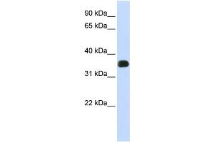 WB Suggested Anti-C2orf47 Antibody Titration:  0. (C2orf47 anticorps  (Middle Region))