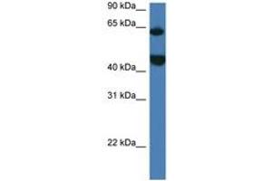 Image no. 1 for anti-Lysophosphatidylcholine Acyltransferase 2 (LPCAT2) (AA 167-216) antibody (ABIN6747272)