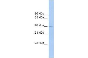 Human Lung; WB Suggested Anti-FCRLA Antibody Titration: 0. (FCRLA anticorps  (C-Term, Isoform 9, Middle Region))