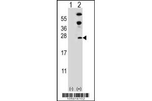 Western blot analysis of DUSP14 using rabbit polyclonal DUSP14 Antibody (D183) using 293 cell lysates (2 ug/lane) either nontransfected (Lane 1) or transiently transfected (Lane 2) with the DUSP14 gene.