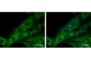 ICC/IF Image COX6A2 antibody [N3C3] detects COX6A2 protein at mitochondria by immunofluorescent analysis. (COX6A2 anticorps  (C-Term))