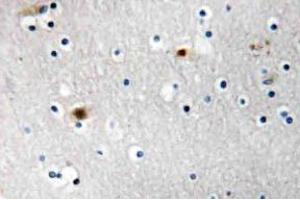 Immunohistochemistry (IHC) analyzes of TAF I p48 antibody in paraffin-embedded human brain carcinoma tissue. (SET/TAF-I anticorps)