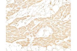 anti-Myoglobin (MB) antibody