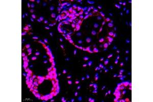 Immunofluorescence of paraffin embedded rat breast using GTF3C3 (ABIN7074039) at dilution of 1: 650 (400x lens)