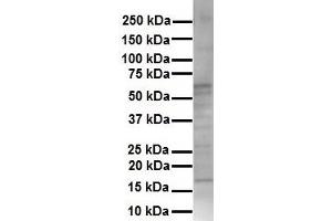 WB Suggested Anti-KRT16 antibody Titration: 1 ug/mL Sample Type: Human HepG2 (KRT16 anticorps  (Middle Region))