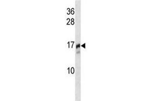 TRAPPC2 antibody western blot analysis in NCI-H292 lysate.