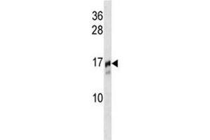 TRAPPC2 antibody western blot analysis in NCI-H292 lysate. (TRAPPC2 anticorps  (AA 11-39))