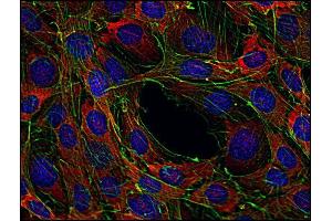 Western Blotting analysis (reducing conditions) of human Sos using anti-Sos (SOS-01). (Sos anticorps)