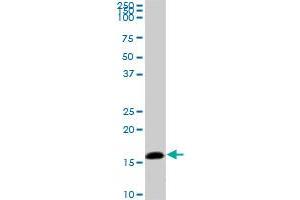 NME2 monoclonal antibody (M06), clone 1D3.