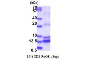SDS-PAGE (SDS) image for Caspase 2, Apoptosis-Related Cysteine Peptidase (CASP2) (AA 348-452) protein (His tag) (ABIN5853713)