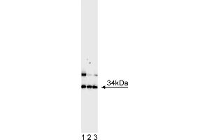 Western Blotting (WB) image for anti-Achaete-Scute Complex Homolog 1 (Drosophila) (ASCL1) antibody (ABIN967560) (ASCL1 anticorps)
