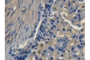 DAB staining on IHC-P; Samples: Mouse Stomach Tissue (TRAPPC10 anticorps  (AA 1077-1259))