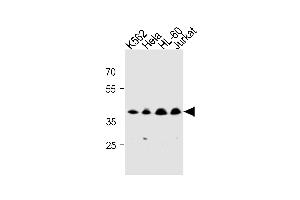 MECR Antibody (Center) (ABIN1881536 and ABIN2843275) western blot analysis in K562,Hela,HL-60,Jurkat cell line lysates (35 μg/lane). (MECR anticorps  (AA 201-229))